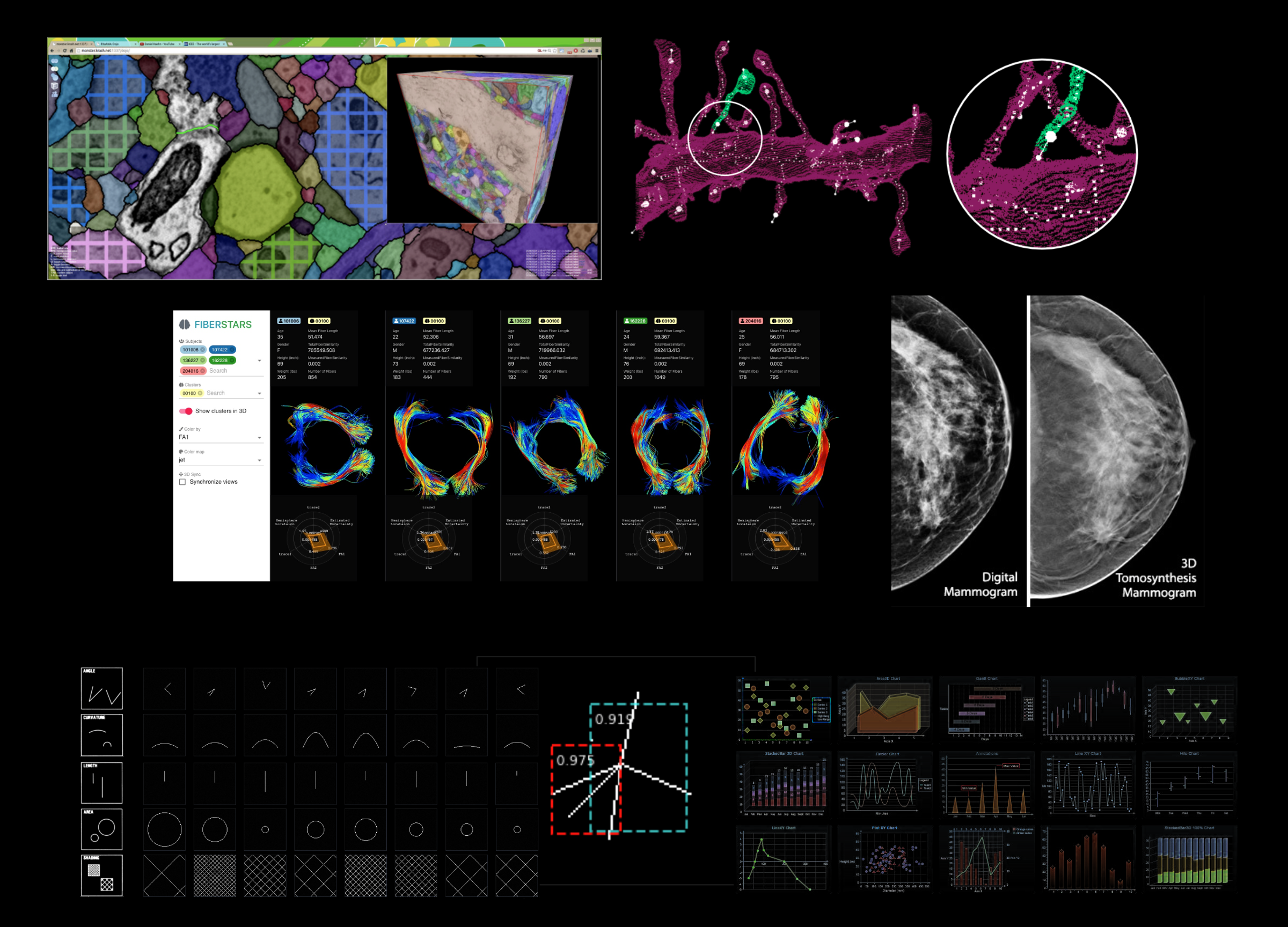 Step 2 - Mammography Database
